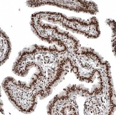 Immunohistochemistry-Paraffin: NFkB2/NFkB p100 Antibody (CL8266) [NBP2-88914]