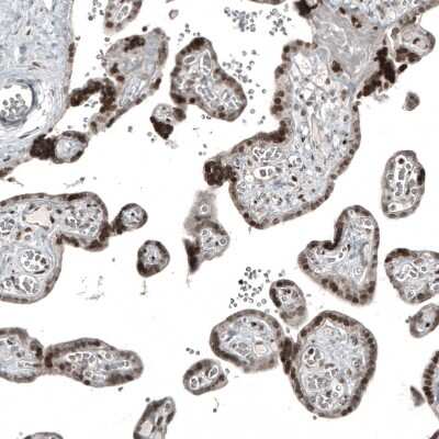 Immunohistochemistry-Paraffin: NFkB2/NFkB p100 Antibody (CL8266) [NBP2-88914]