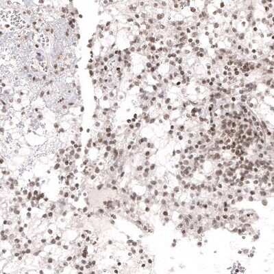 Immunohistochemistry-Paraffin: NFkB2/NFkB p100 Antibody (CL8266) [NBP2-88914]