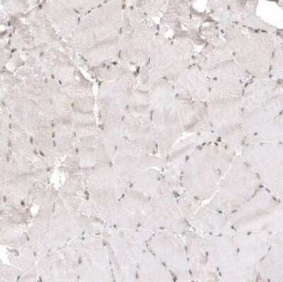 Immunohistochemistry-Paraffin: NFkB2/NFkB p100 Antibody (CL8266) [NBP2-88914]