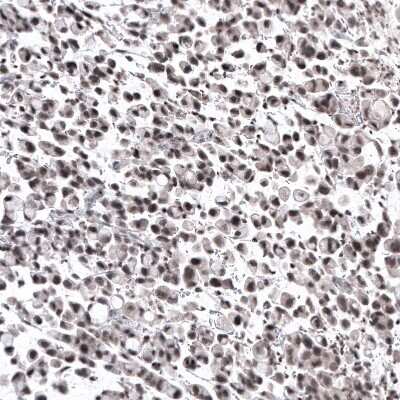 Immunohistochemistry-Paraffin: NFkB2/NFkB p100 Antibody (CL8266) [NBP2-88914]