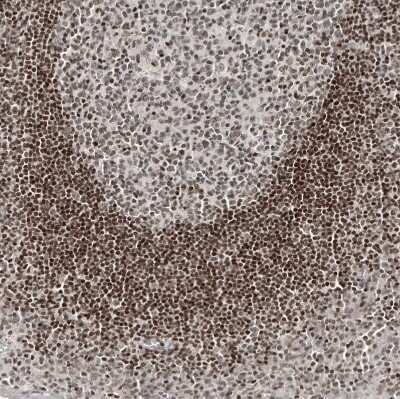 Immunohistochemistry-Paraffin: NFkB2/NFkB p100 Antibody (CL8266) [NBP2-88914]