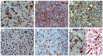 Immunohistochemistry: NG2/MCSP Antibody [NBP1-89682]