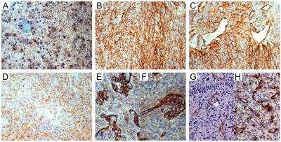 Immunohistochemistry: NG2/MCSP Antibody [NBP1-89682]