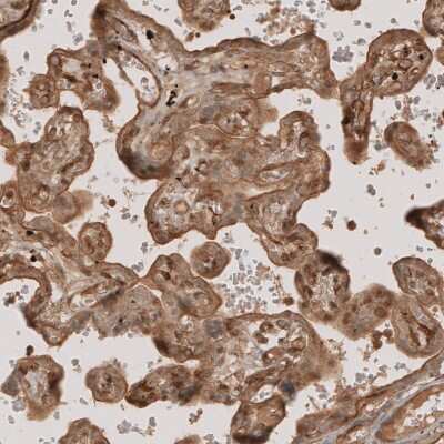 Immunohistochemistry-Paraffin: NG2/MCSP Antibody [NBP1-89682]