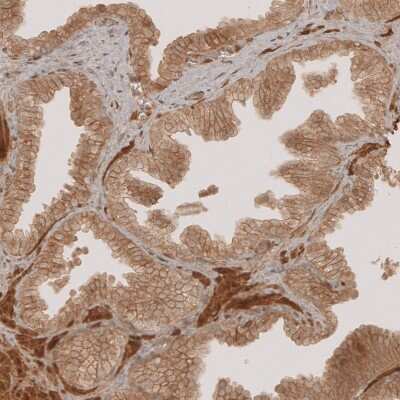 Immunohistochemistry-Paraffin: NG2/MCSP Antibody [NBP1-89682]