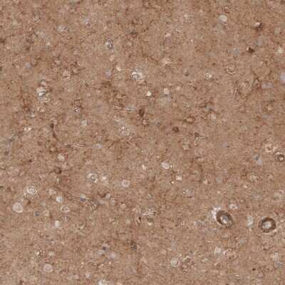 Immunohistochemistry-Paraffin: NG2/MCSP Antibody [NBP1-89682]