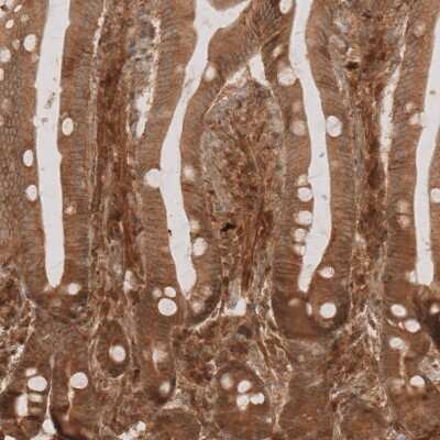 Immunohistochemistry-Paraffin: NG2/MCSP Antibody [NBP1-89682]