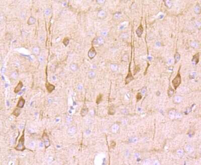 Immunohistochemistry-Paraffin: NG2/MCSP Antibody (JM10-13) [NBP2-66979]