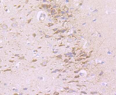 Immunohistochemistry-Paraffin: NG2/MCSP Antibody (JM10-13) [NBP2-66979]