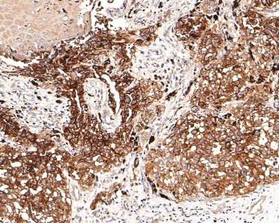 Immunohistochemistry-Paraffin: NG2/MCSP Antibody (JM10-13) [NBP2-66979]