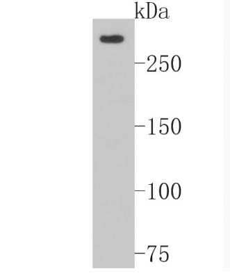 Western Blot: NG2/MCSP Antibody (JM10-13) [NBP2-66979]