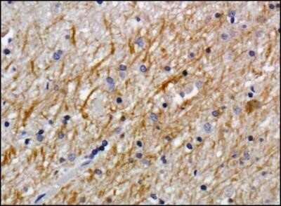 Immunohistochemistry: NG2/MCSP Antibody (LHM 2) - Azide and BSA Free [NBP2-80873]