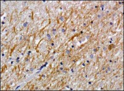 Immunohistochemistry-Paraffin: NG2/MCSP Antibody (LHM 2) [NB100-2688]