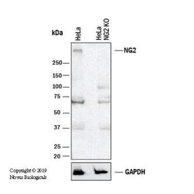 Knockout Validated: NG2/MCSP Antibody (LHM 2) [NB100-2688]