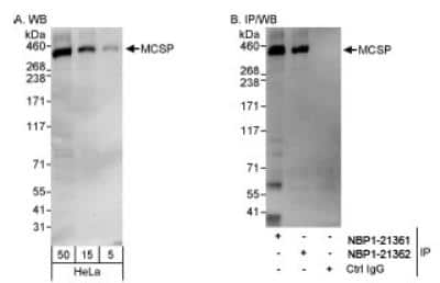 Western Blot: NG2/MCSP Antibody [NBP1-21361]