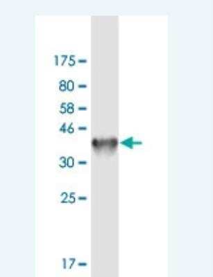 Western Blot: NGEF Antibody (6E7) [H00025791-M01-100ug]