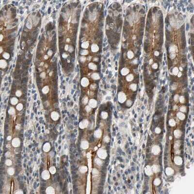 Immunohistochemistry-Paraffin: NGEF Antibody [NBP1-88820]