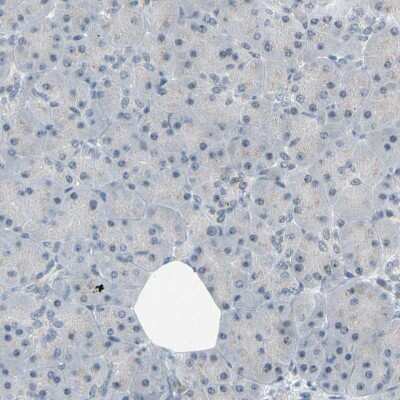 Immunohistochemistry-Paraffin: NGEF Antibody [NBP1-88820]