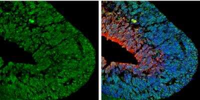 Immunohistochemistry-Frozen: NGFR/TNFRSF16/p75NTR Antibody [NBP2-19669]
