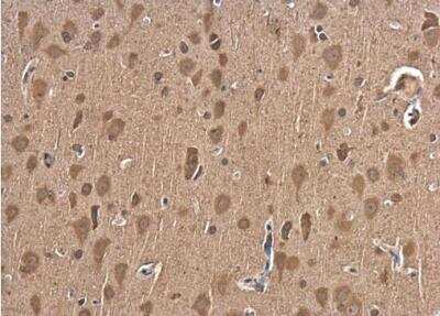 Immunohistochemistry-Paraffin: NGFR/TNFRSF16/p75NTR Antibody [NBP2-19669]