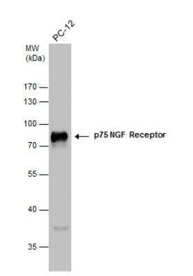 Western Blot: NGFR/TNFRSF16/p75NTR Antibody [NBP2-19669]