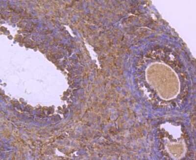 Immunohistochemistry-Paraffin: NGFI-B alpha/Nur77/NR4A1 Antibody (JM59-11) [NBP2-66980]