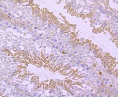 Immunohistochemistry-Paraffin: NGFI-B alpha/Nur77/NR4A1 Antibody (JM59-11) [NBP2-66980]