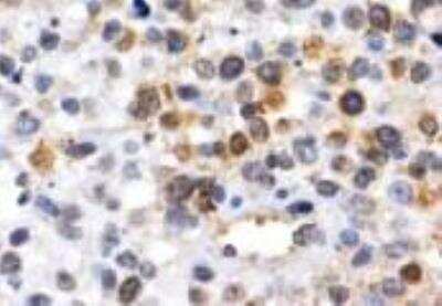 Immunohistochemistry-Paraffin: NGFI-B alpha/Nur77/NR4A1 Antibody (JM59-11) [NBP2-66980]