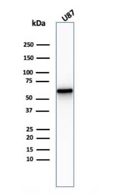 Western Blot: NGFR/TNFRSF16/p75NTR Antibody (NGFR/2550R)Azide and BSA Free [NBP3-08566]