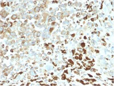 Immunohistochemistry-Paraffin: NGFR/TNFRSF16/p75NTR Antibody (NGFR/2550R) [NBP3-07408]