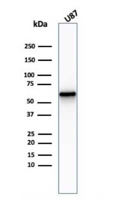 Western Blot: NGFR/TNFRSF16/p75NTR Antibody (NGFR/2550R) [NBP3-07408]