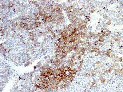 Immunohistochemistry-Paraffin: NGFR/TNFRSF16/p75NTR Antibody (NGFR5 + NTR/912) - Azide and BSA Free [NBP2-47967]