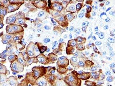 Immunohistochemistry-Paraffin: NGFR/TNFRSF16/p75NTR Antibody (NGFR5) - Azide and BSA Free [NBP2-47965]