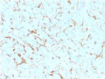 Immunohistochemistry-Paraffin: NGFR/TNFRSF16/p75NTR Antibody (NGFR5) - Azide and BSA Free [NBP2-47965]