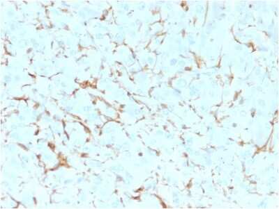 Immunohistochemistry-Paraffin: NGFR/TNFRSF16/p75NTR Antibody (NGFR5) [NBP2-44874]