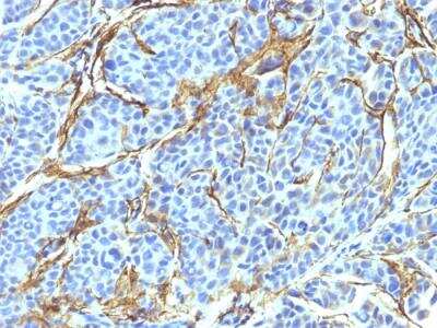 Immunohistochemistry-Paraffin: NGFR/TNFRSF16/p75NTR Antibody (NTR/912) - Azide and BSA Free [NBP2-47966]