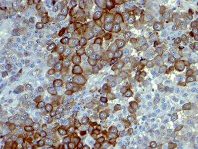 Immunohistochemistry-Paraffin: NGFR/TNFRSF16/p75NTR Antibody (NTR/912) - Azide and BSA Free [NBP2-47966]