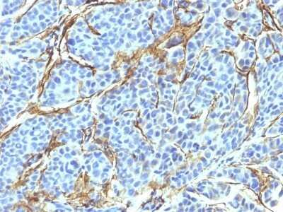 Immunohistochemistry-Paraffin: NGFR/TNFRSF16/p75NTR Antibody (NTR/912) [NBP2-44876]