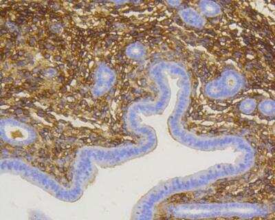 Immunohistochemistry-Paraffin: NGFR/TNFRSF16/p75NTR Antibody (SA39-02) [NBP2-67296]