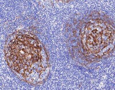Immunohistochemistry-Paraffin: NGFR/TNFRSF16/p75NTR Antibody (SA39-02) [NBP2-67296]
