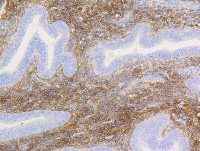 Immunohistochemistry-Paraffin: NGFR/TNFRSF16/p75NTR Antibody (SA39-02) [NBP2-67296]