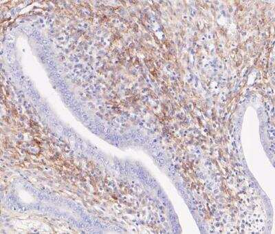 Immunohistochemistry-Paraffin: NGFR/TNFRSF16/p75NTR Antibody (SA39-02) [NBP2-67296]