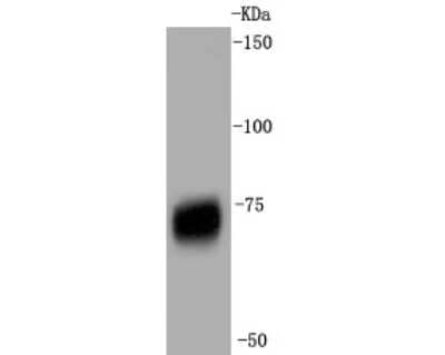 Western Blot: NGFR/TNFRSF16/p75NTR Antibody (SA39-02) [NBP2-67296]