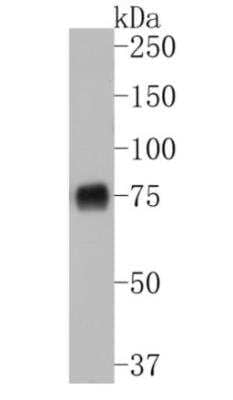 Western Blot: NGFR/TNFRSF16/p75NTR Antibody (SA39-02) [NBP2-67296]