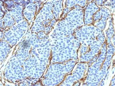 Immunohistochemistry-Paraffin: NGFR/TNFRSF16/p75NTR Antibody (SPM299) - Azide and BSA Free [NBP3-11470]