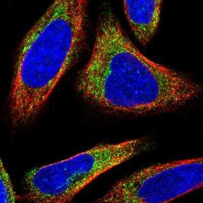 Immunocytochemistry/ Immunofluorescence: NGFRAP1/BEX3/NADE Antibody [NBP1-89987]