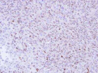 Immunohistochemistry-Paraffin: NGFRAP1/BEX3/NADE Antibody [NBP1-31652]