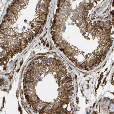 Immunohistochemistry-Paraffin: NGFRAP1/BEX3/NADE Antibody [NBP1-89987]