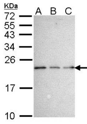 Western Blot: NGFRAP1/BEX3/NADE Antibody [NBP1-31652]